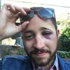 Man Sucker-Punched On LES "Because You Look Like Shia LaBeouf"